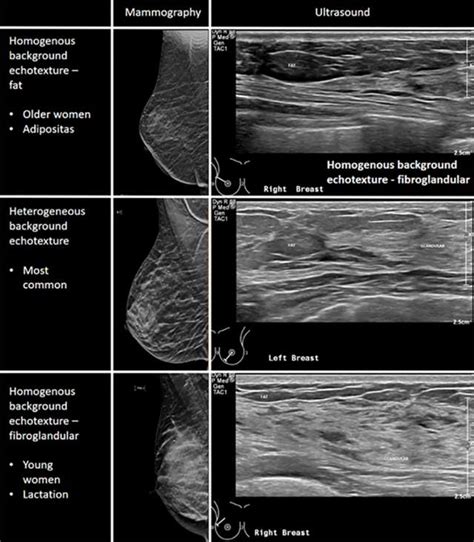 the villages breast ultrasound|Ultrasound .